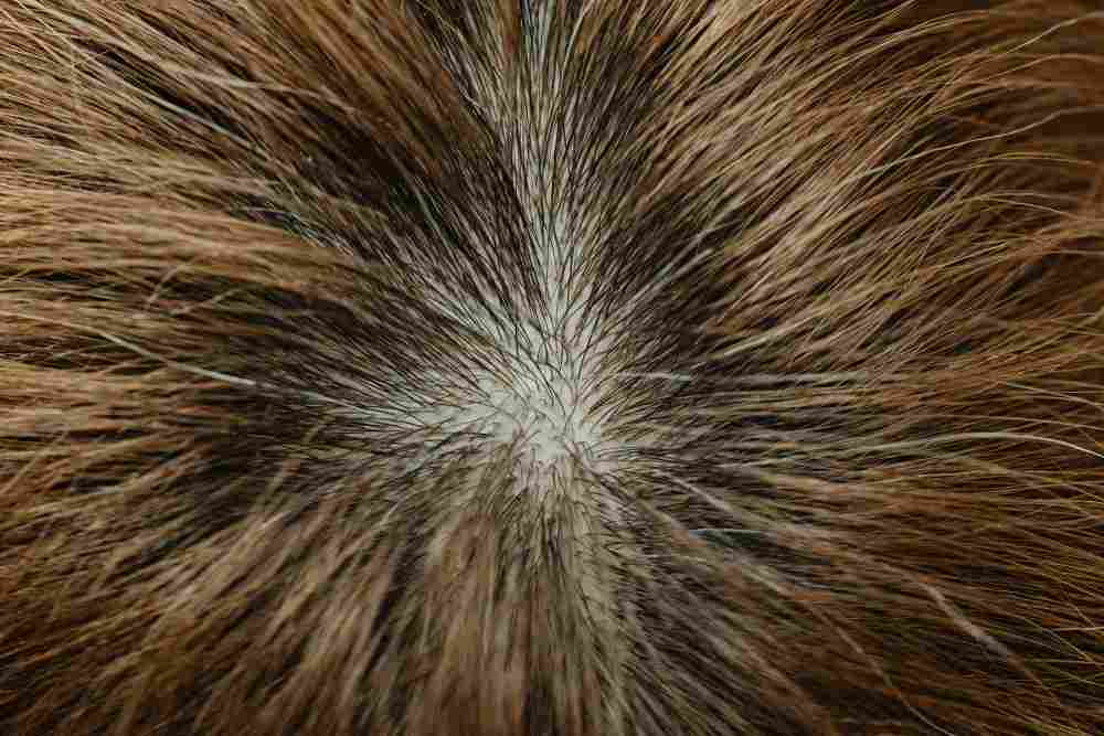 Présentation d'une photo d'un crane perte de cheveux pour pelade