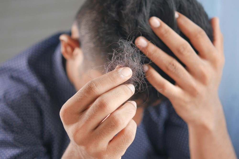 Présentation d'un homme souffrant de pelade cheveux perte maladie auto-immune