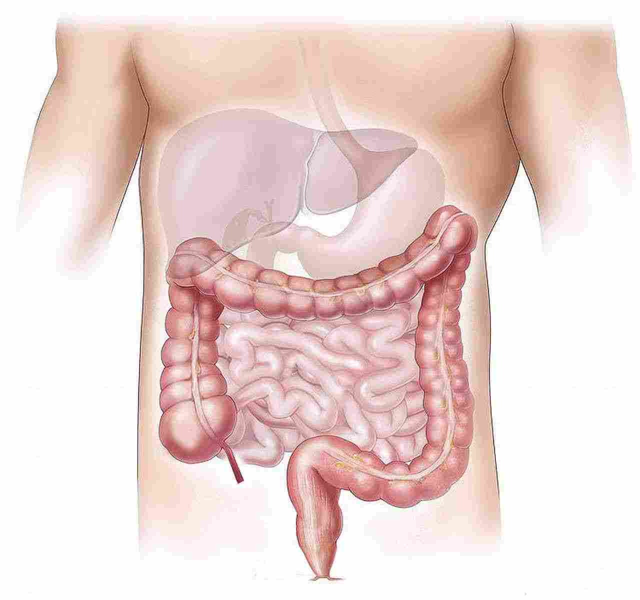 Combien de temps dure une crise de diverticulite colon humain