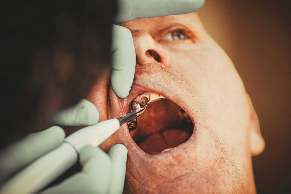 Homme avec abcès et soins dentaires