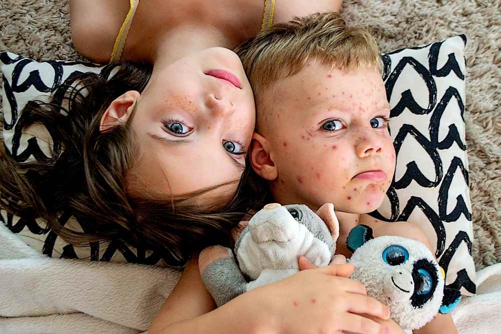 Peut-on attraper la varicelle 2 fois, enfants malades
