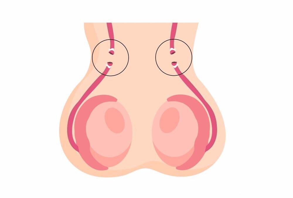 Vasectomie homme : Moyen de contraception et effets secondaires