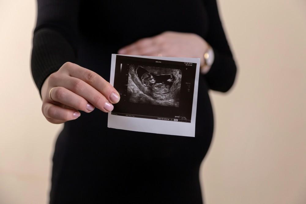 Peut on tomber enceinte pendant les règles, femme ayant fait une échographie