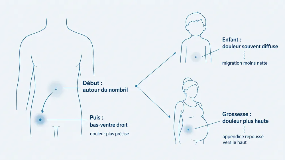 La douleur ne commence pas toujours à droite : le repère utile est son déplacement et sa fixation, pas sa position de départ